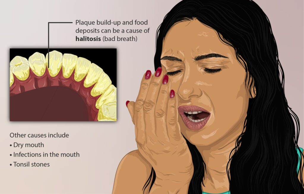 SOLUTION TO GET RID OF BAD BREATH AND ANY MOUTH/TEETH PROBLEMS PERMANENTLY.