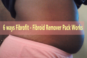 FIBROID SOLUTION PACK